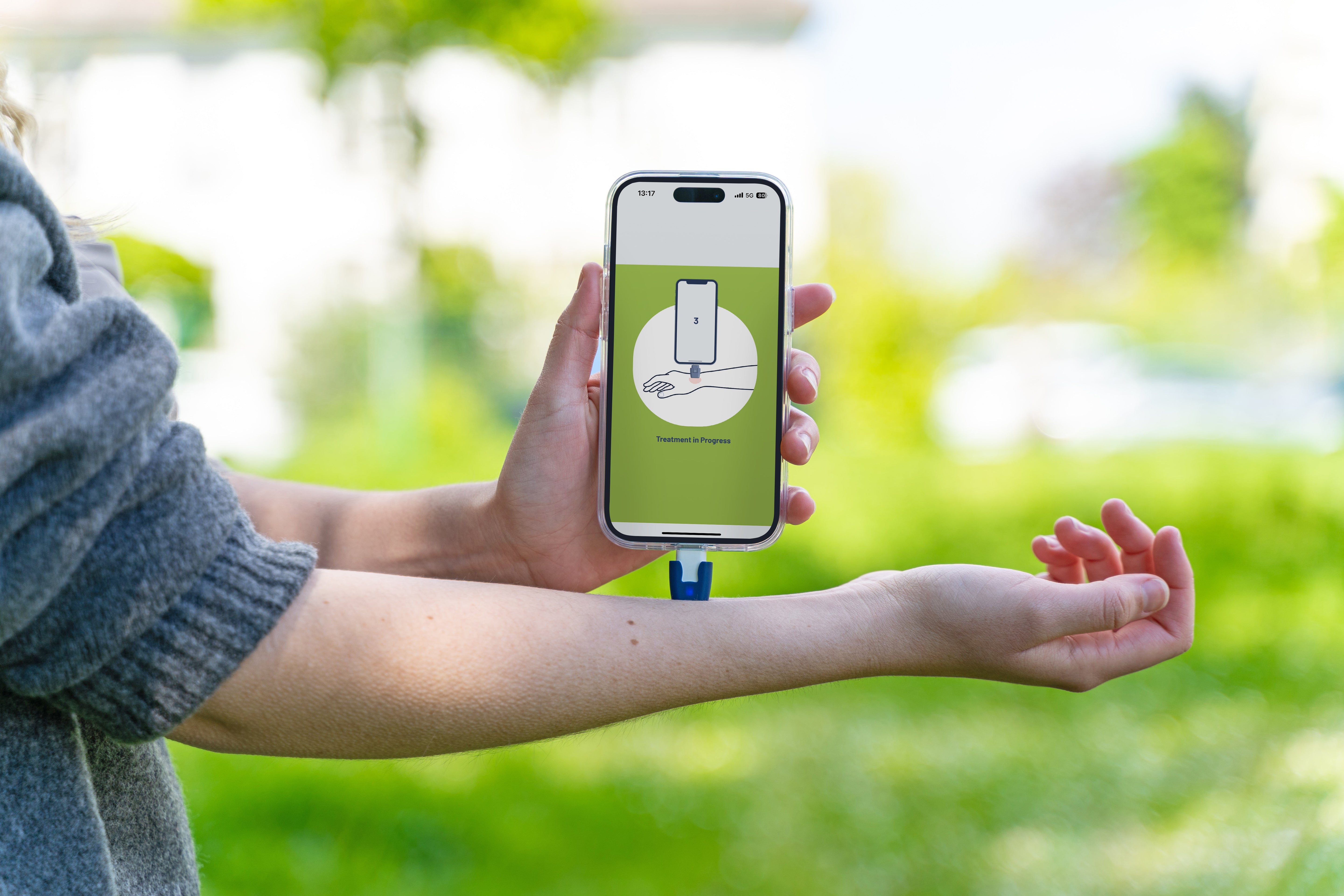 heat it® insect bite relief device applying controlled heat to the skin, guided by a smartphone app